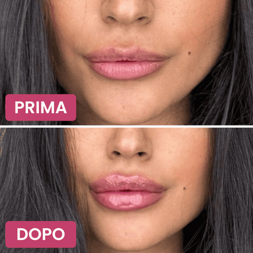 Volumizzante labbra Beynia