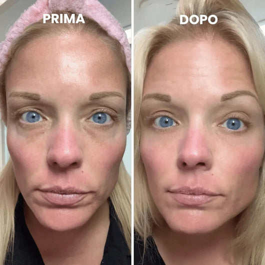 Balsamo tutto-in-uno per il rinnovamento del contorno occhi