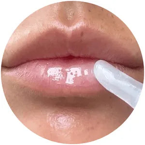 Attendi 5–10 minuti