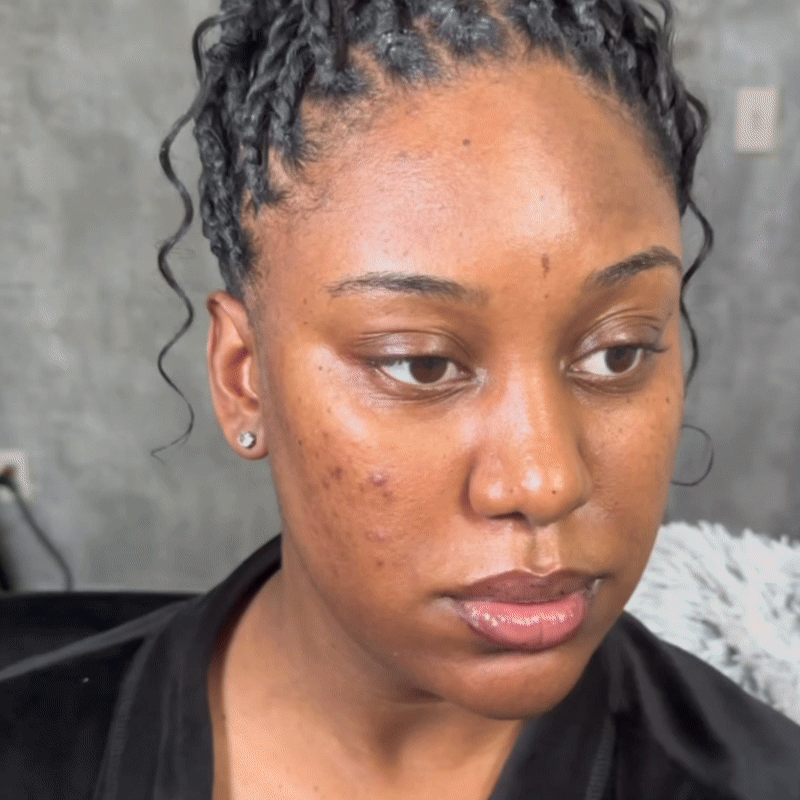 Illumina la pelle, attenua le macchie scure e uniforma l’incarnato