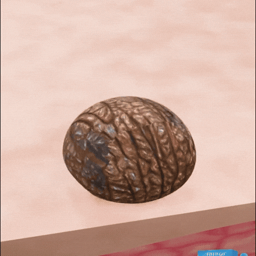 Non dovrai mai più nascondere la tua pelle