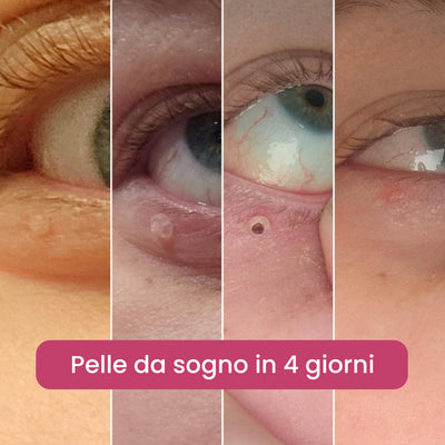 Kit completo BEYNIA™