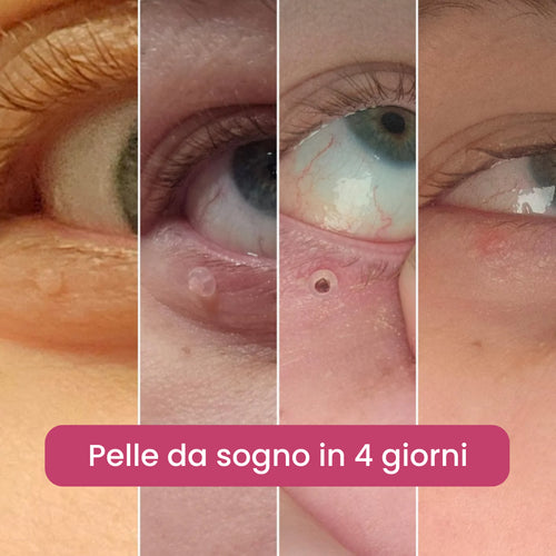 Kit completo BEYNIA™