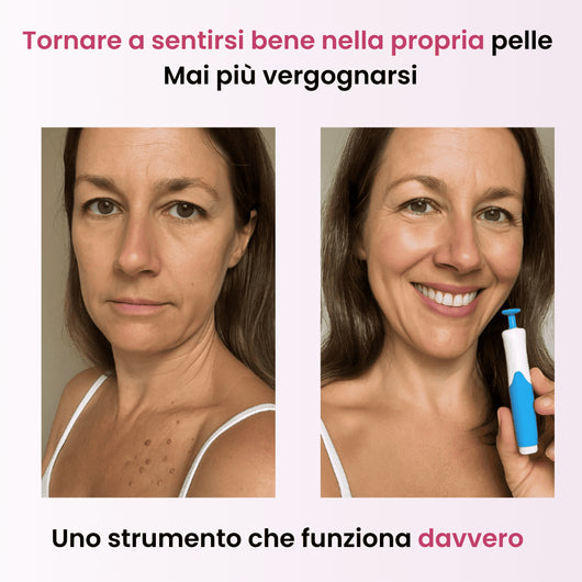 Kit completo BEYNIA™