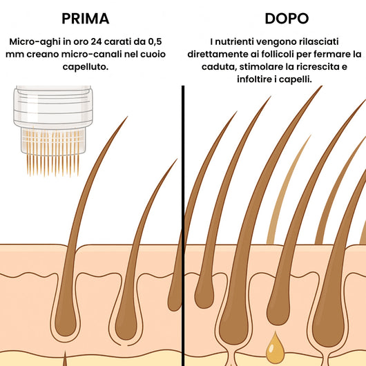 Tecnologia capillare Micro-infuse® Uomo