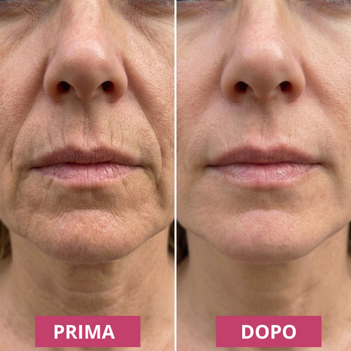 Balsamo anti-rughe al collagene e calcio