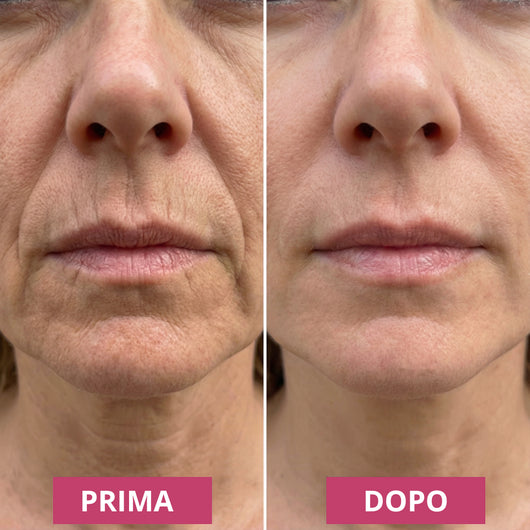 Balsamo anti-rughe al collagene e calcio