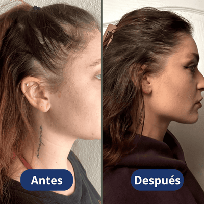 Aceite de crecimiento para el cabello (60 ml)