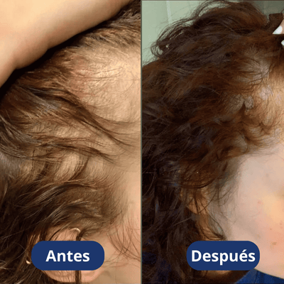Aceite de crecimiento para el cabello (60 ml)