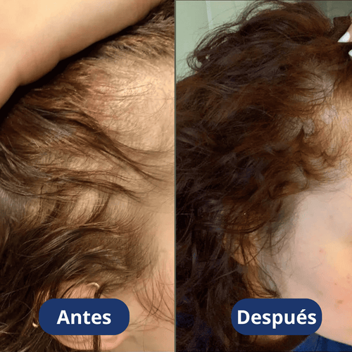 Aceite de crecimiento para el cabello (60 ml)