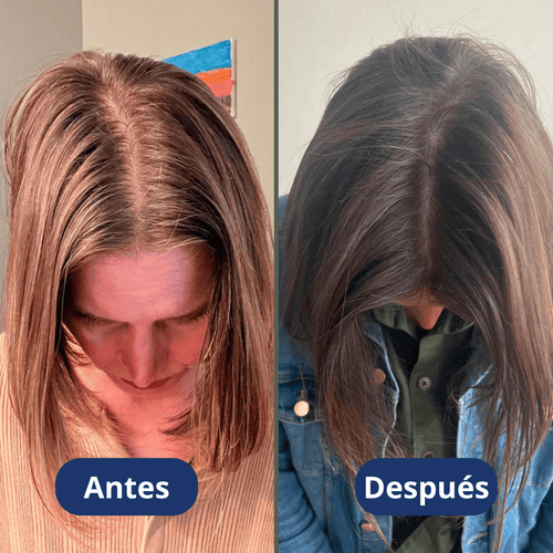 Aceite de crecimiento para el cabello (60 ml)