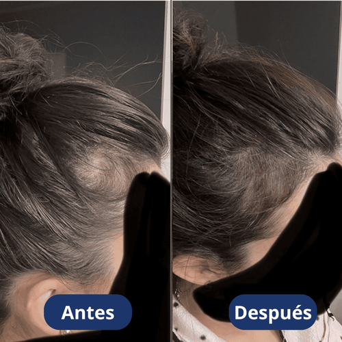 Aceite de crecimiento para el cabello (60 ml)