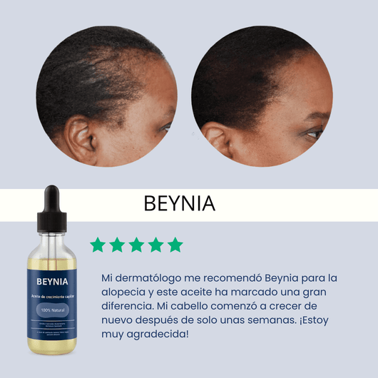 Aceite de crecimiento para el cabello (60 ml)