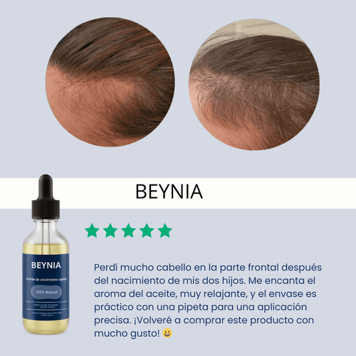 Aceite de crecimiento para el cabello (60 ml)