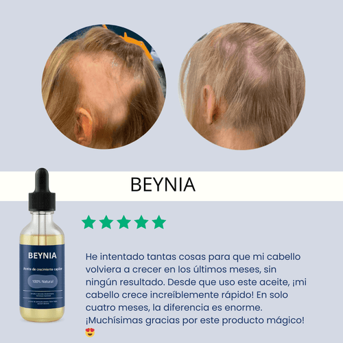 Aceite de crecimiento para el cabello (60 ml)