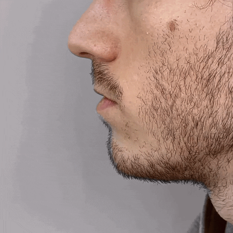 Comment Beynia fonctionne ?