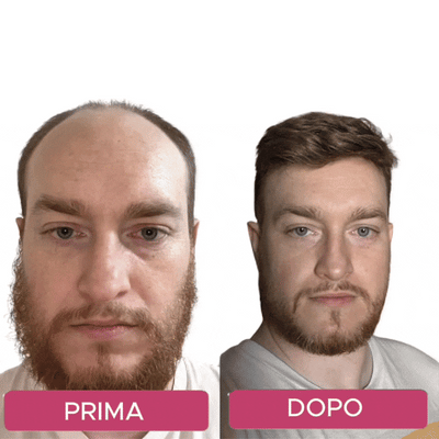 Tecnologia capillare Micro-infuse® Uomo