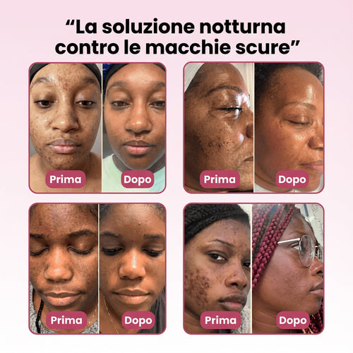 Beynia - Maschera coreana alla curcuma e collagene