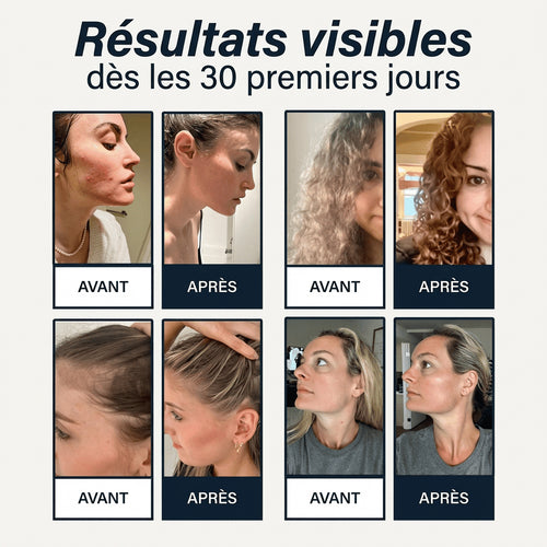 Commencez l’année sans sécheresse ni démangeaisons après chaque douche avec Beynia™