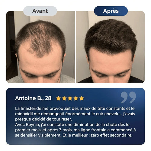 Beynia™ – Sérum régénérant pour cheveux