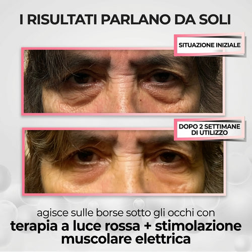 OcchiLumi® Terapia a Luce Rossa 2-in-1 + Balsamo Contorno Occhi