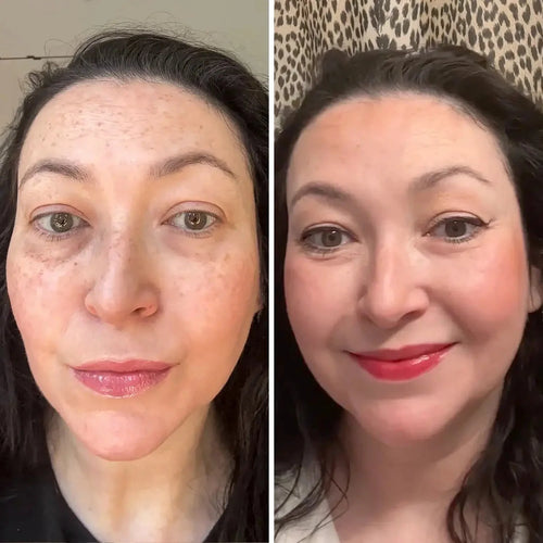 Balsamo tutto-in-uno per il rinnovamento del contorno occhi