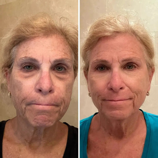 Balsamo tutto-in-uno per il rinnovamento del contorno occhi