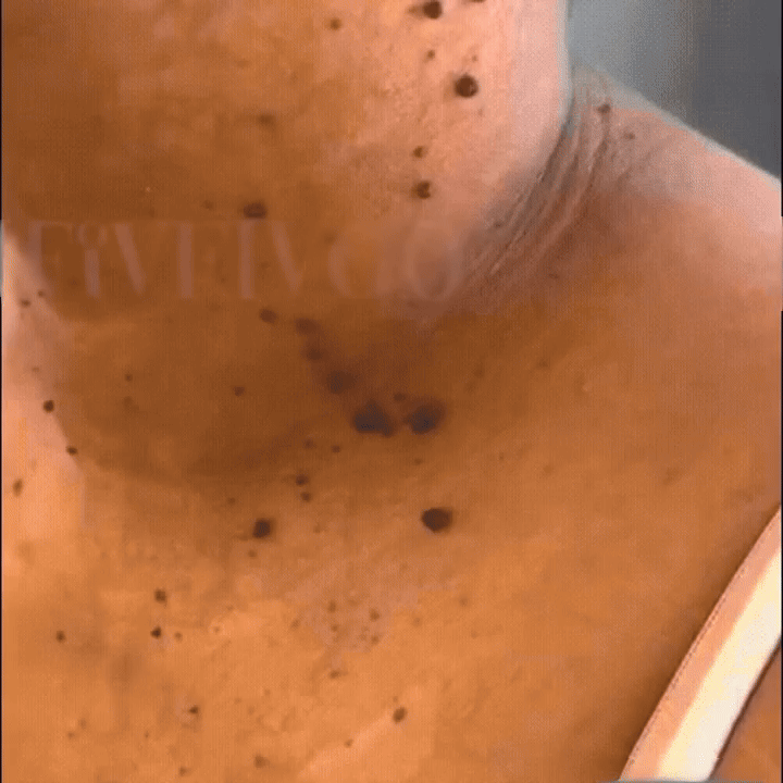 Come funziona — semplice, preciso, comprovato